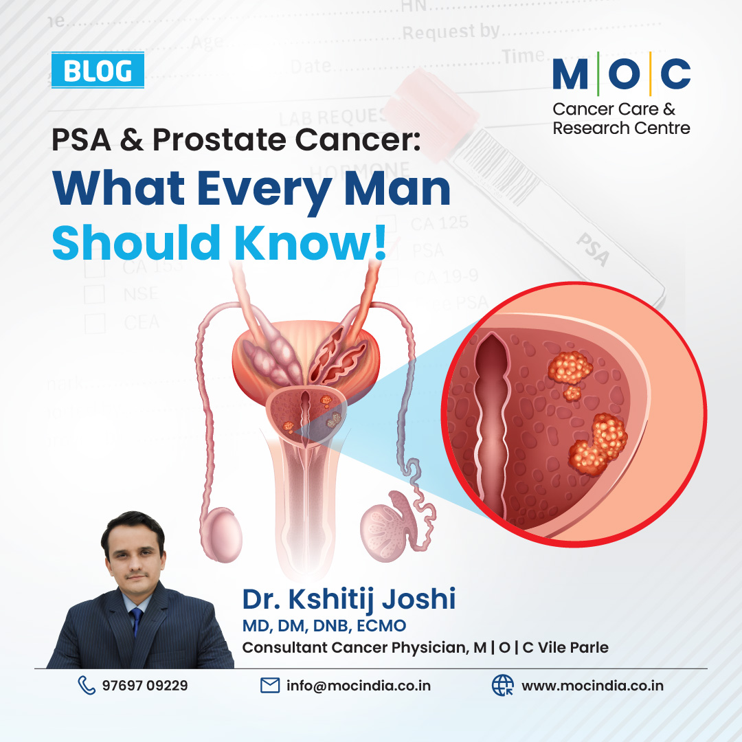 PSA and Prostate Cancer: What Every Man Should Know!